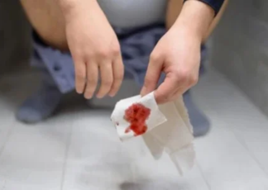 Blood Vomitings & Motions Thumbnail